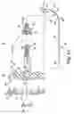 Fig. 03 - Device, system and method for delivering a curable material into bone