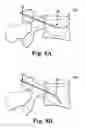 Fig. 15 - Device, system and method for delivering a curable material into bone