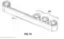 Fig. 11 - Cervical seal apparatus and method of sealing a cervix