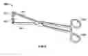 Fig. 16 - Cervical seal apparatus and method of sealing a cervix