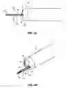 Fig. 04 - Helical tissue manipulation instruments and methods of use