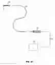 Fig. 07 - Helical tissue manipulation instruments and methods of use