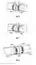 Fig. 04 - Compression anastomosis device