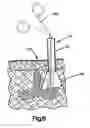 Fig. 04 - Structure for receiving surgical instruments