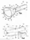 Fig. 06 - Structure for receiving surgical instruments