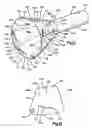 Fig. 07 - Structure for receiving surgical instruments