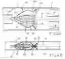 Fig. 05 - Interventional catheter for retrograde use having embolic protection capability and methods of use