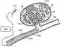 Fig. 01 - EMBOLIC COILS