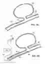 Fig. 05 - EMBOLIC COILS