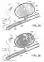 Fig. 07 - EMBOLIC COILS