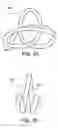 Fig. 10 - EMBOLIC COILS