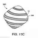 Fig. 16 - EMBOLIC COILS