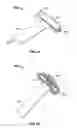 Fig. 05 - Cervical clamp apparatus and method of exerting a compressive force to a cervix