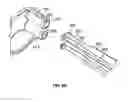 Fig. 09 - Cervical clamp apparatus and method of exerting a compressive force to a cervix