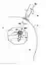 Fig. 01 - Suture anchor device, kit and method