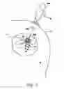 Fig. 04 - Suture anchor device, kit and method