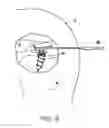Fig. 05 - Suture anchor device, kit and method