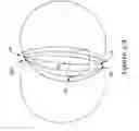 Fig. 03 - Subcutaneous implantable cardioverter-defibrillator placement methods