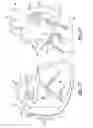 Fig. 05 - Implantable device for treating epilepsy and cardiac rhythm disorders