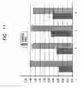 Fig. 08 - Stimulation of the sphenopalatine ganglion for treating depression