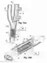 Fig. 09 - Apparatus and method for modulating the baroreflex system