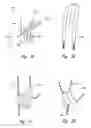 Fig. 03 - Methods and apparatuses for treating an esophageal disorder such as gastroesophageal reflux disease