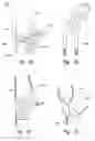 Fig. 04 - Methods and apparatuses for treating an esophageal disorder such as gastroesophageal reflux disease