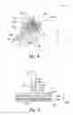 Fig. 06 - Methods and apparatuses for treating an esophageal disorder such as gastroesophageal reflux disease