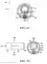 Fig. 08 - Interconnections of implantable lead conductors and electrodes and reinforcement therefor