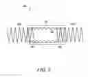 Fig. 11 - Interconnections of implantable lead conductors and electrodes and reinforcement therefor