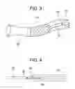 Fig. 04 - Self-expanding stent delivery system