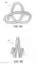 Fig. 08 - Embolic coils