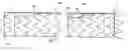 Fig. 01 - Method for aligning a stent graft delivery system