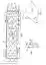 Fig. 02 - Method for aligning a stent graft delivery system