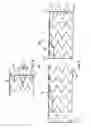 Fig. 04 - Method for aligning a stent graft delivery system
