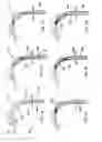 Fig. 08 - Method for aligning a stent graft delivery system