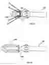 Fig. 11 - Method for aligning a stent graft delivery system