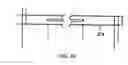 Fig. 17 - Method for aligning a stent graft delivery system