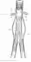 Fig. 01 - Design and assembly of fenestrated stent grafts
