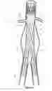 Fig. 02 - Design and assembly of fenestrated stent grafts