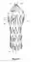 Fig. 08 - Design and assembly of fenestrated stent grafts