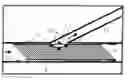 Fig. 01 - STENT INCLUDING A PORTAL AND METHODS OF USE THEREOF