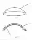 Fig. 02 - Biological artificial cornea and method of making