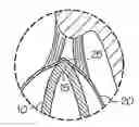 Fig. 01 - Method in eye surgery