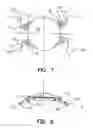 Fig. 05 - Refractive intraocular implant lens and method