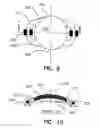 Fig. 06 - Refractive intraocular implant lens and method