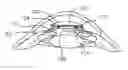 Fig. 01 - Refractive intraocular implant lens and method