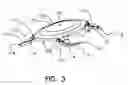 Fig. 03 - Refractive intraocular implant lens and method