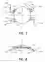 Fig. 05 - Refractive intraocular implant lens and method