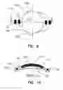 Fig. 06 - Refractive intraocular implant lens and method